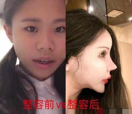 男网红整容脸吃瓜视频,吃瓜群众热议的整形真相 第3张 男网红整容脸吃瓜视频,吃瓜群众热议的整形真相 第3张